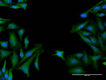 CD8A monoclonal antibody (M10), clone 4B9