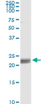 CD8A monoclonal antibody (M10), clone 4B9