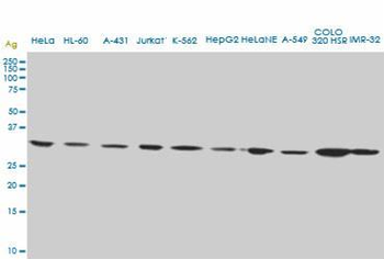 CD5L monoclonal antibody (M01), clone 1C8