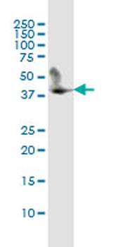 CD5L monoclonal antibody (M01), clone 1C8