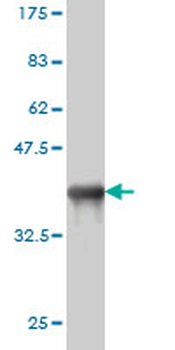 CD5L monoclonal antibody (M01), clone 1C8