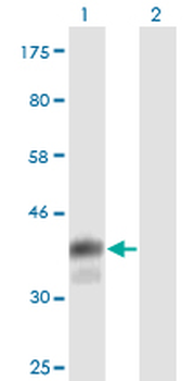 CD5 monoclonal antibody (M01), clone 2F7