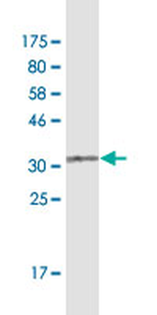CD5 monoclonal antibody (M01), clone 2F7