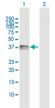 CD1B MaxPab rabbit polyclonal antibody (D01)