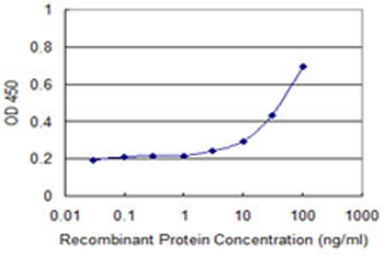 CD1A monoclonal antibody (M01), clone M1-2-1B5