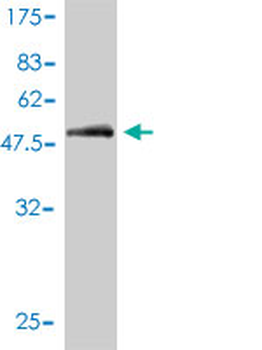 CD1A monoclonal antibody (M01), clone M1-2-1B5