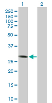 CCND3 purified MaxPab rabbit polyclonal antibody (D01P)