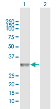 CCND2 MaxPab rabbit polyclonal antibody (D01)
