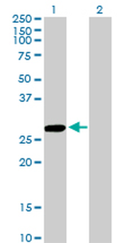 CCBL1 monoclonal antibody (M02), clone 1B12
