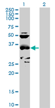 CCBL1 purified MaxPab mouse polyclonal antibody (B01P)