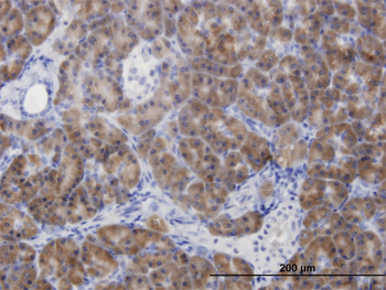 CBS monoclonal antibody (M07), clone 5F7