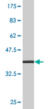 CBS monoclonal antibody (M07), clone 5F7