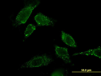CBR3 monoclonal antibody (M05), clone 1G8