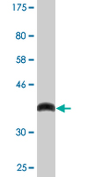 CBR3 monoclonal antibody (M05), clone 1G8