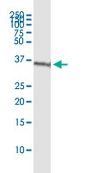 CBR3 MaxPab rabbit polyclonal antibody (D01)