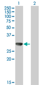 CBR3 purified MaxPab mouse polyclonal antibody (B01P)