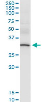 CBR1 MaxPab rabbit polyclonal antibody (D01)