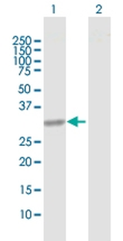 CBR1 MaxPab rabbit polyclonal antibody (D01)