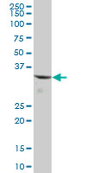 CBR1 purified MaxPab mouse polyclonal antibody (B01P)