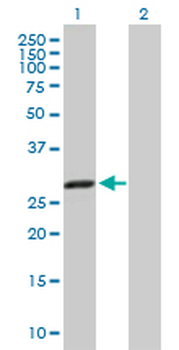 CBR1 purified MaxPab mouse polyclonal antibody (B01P)