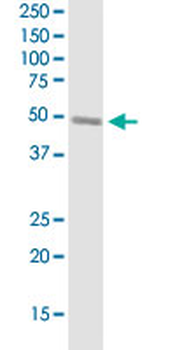 SERPINH1 monoclonal antibody (M01J), clone 1D2-1A6