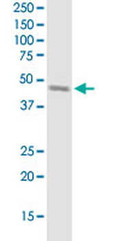 SERPINH1 monoclonal antibody (M01J), clone 1D2-1A6