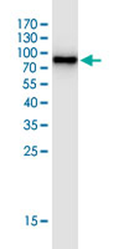 SERPINH1 monoclonal antibody (M01J), clone 1D2-1A6