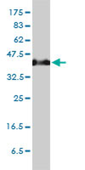 SERPINH1 monoclonal antibody (M01), clone 1D2-1A6