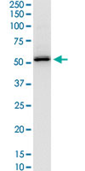 SERPINH1 monoclonal antibody (M01), clone 1D2-1A6