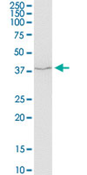 SERPINH1 monoclonal antibody (M01), clone 1D2-1A6