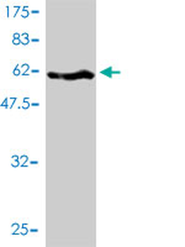 SERPINH1 monoclonal antibody (M01), clone 1D2-1A6