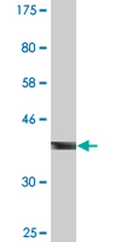 CBL monoclonal antibody (M01), clone 6D12