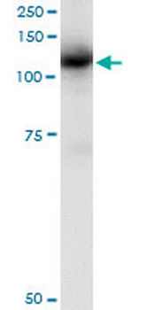 CBL monoclonal antibody (M01), clone 6D12