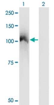 CBL monoclonal antibody (M01), clone 6D12