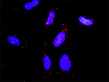 CBL purified MaxPab rabbit polyclonal antibody (D01P)