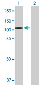CBL purified MaxPab rabbit polyclonal antibody (D01P)