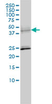 SERPINA6 monoclonal antibody (M02), clone 1D9
