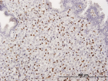RUNX3 MaxPab mouse polyclonal antibody (B01)