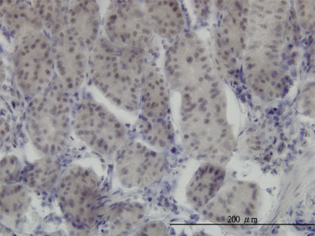 RUNX1 monoclonal antibody (M06), clone 2C10