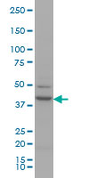 RUNX1 monoclonal antibody (M06), clone 2C10