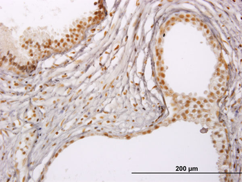 RUNX1 monoclonal antibody (M02), clone 3A1