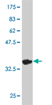 RUNX1 monoclonal antibody (M02), clone 3A1
