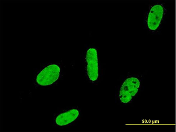 RUNX2 monoclonal antibody (M05), clone 1D2