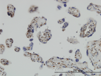 RUNX2 monoclonal antibody (M05), clone 1D2