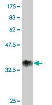 RUNX2 monoclonal antibody (M05), clone 1D2