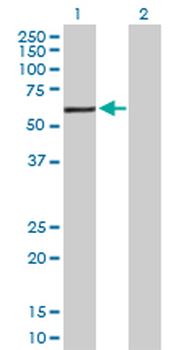 CAT purified MaxPab rabbit polyclonal antibody (D01P)