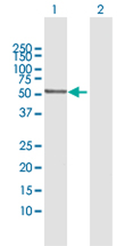 CAT MaxPab rabbit polyclonal antibody (D01)