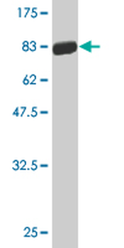 CASQ2 monoclonal antibody (M07), clone 1C6