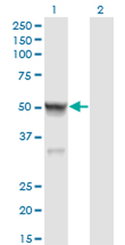 CASQ2 monoclonal antibody (M01), clone 1B6
