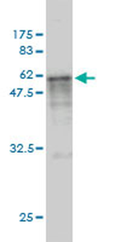 CASQ2 monoclonal antibody (M01), clone 1B6